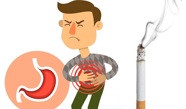 Chuyên gia giải đáp: Hút thuốc lá có bị đau dạ dày không?
