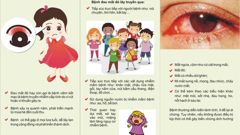 Huyện Đăk Song Khuyến cáo các biện pháp phòng bệnh đau mắt đỏ